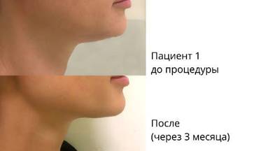 Предновогоднее предложение, которое бывает раз в году!*