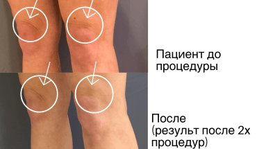 Предновогоднее предложение, которое бывает раз в году!*